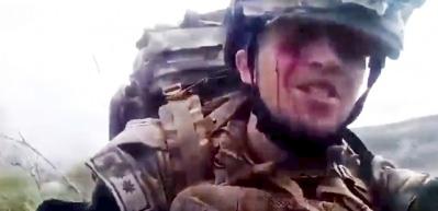 Karabağ'da yaralı halde &ccedil;ektiği videoyla duygulandıran askerin &ouml;lmediği ortaya &ccedil;ıktı!