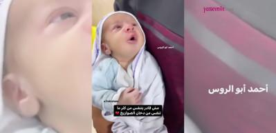 İsrail'in attığı gaz bombalarının dumanından etkilenen minik bebeğin g&ouml;r&uuml;nt&uuml;s&uuml; y&uuml;rekleri acıttı