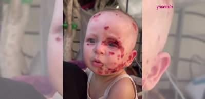 Ailesinin yüzüne bakmaya kıyamadığı Mira bebek İsrail saldırılarıyla tanınmaz hale geldi!