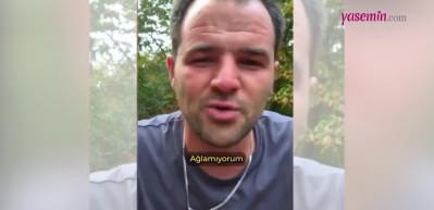 Arının iğnesi ile dudaklarını şişirdi! 'Bir botoks komedisi' diyerek paylaştı