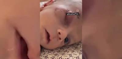 Kundaktaki bebek İsrail saldırılarında bir g&ouml;z&uuml;n&uuml; kaybetti