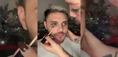 Mauro Icardi'nin eşinden rekor kıran anlar! 3 dakikada gözündeki morluğu kapattı