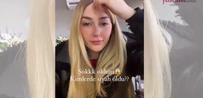 Ağızları açık bıraktı! Altın yüzük ile demir eksikliği testi sosyal medyayı kasıp kavurdu