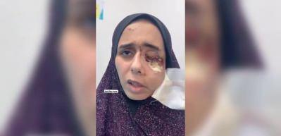 Bombardımanda tek g&ouml;z&uuml;n&uuml; kaybeden Filistinli gen&ccedil; kadının acil tedaviye ihtiyacı var
