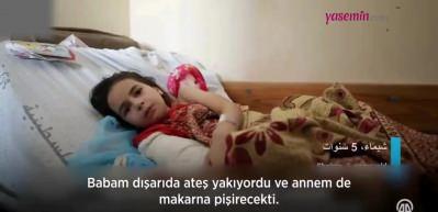 İsrail saldırılarında uzuvlarını kaybeden Gazzeli çocuklardan yürek yakan sözler! "Okula nasıl gideceğim?"