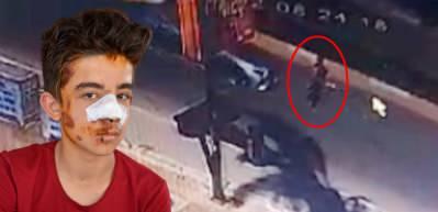 Serik'te k&ouml;peklerden ka&ccedil;an &ccedil;ocuk arabanın altında kaldı
