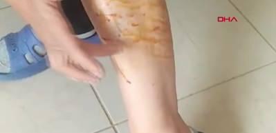 Sabah sporu yapan kadın kabusu yaşadı