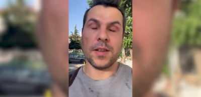 G&ouml;rme engelli fenomen mağduriyetini anlattı! "Tamam, parklar k&ouml;peklerin olsun ama bari işimize rahat gidip gelelim!"