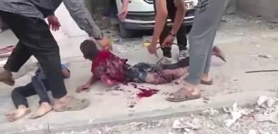 İsrail vahşeti devam ediyor... Bebekler ve &ccedil;ocuklar kanlar i&ccedil;inde