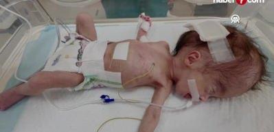 Gazze'de bir milyon &ccedil;ocuk a&ccedil;lıktan &ouml;l&uuml;m tehlikesi yaşıyor