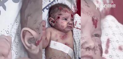 Gazze'de katliamın boyutu kan dondurdu! Gazzeli bebek girdiği şok yüzünden ağlayamadı