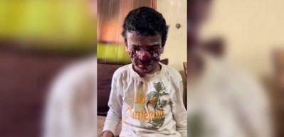 İsrail'in barbarlığı zalimliğin &ccedil;ok &ouml;tesinde! Bu g&ouml;r&uuml;nt&uuml;lere y&uuml;rek dayanmaz
