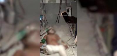Gazze hastanelerinde imkansızlık i&ccedil;inde yapılan operasyonlar