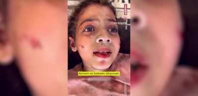 Katil İsrail &ouml;ld&uuml;rmeye devam ediyor!Ailesinden tek sağ kurtulan k&uuml;&ccedil;&uuml;k kızın s&ouml;zleri y&uuml;rekleri dağladı