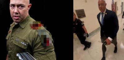 ABD'li senat&ouml;r Brian Mast'a zor soru: Bacaklarına ne oldu, senin &uuml;zerinde de mi kırmızı &uuml;&ccedil;gen vardı?