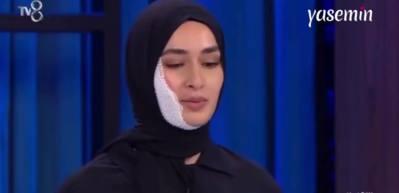 MasterChef'te Beyza Huri Aydın'ın yüzü yanmıştı! Yarışmaya devam edecek mi?