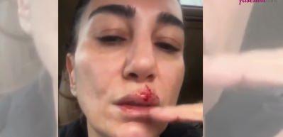 Nadide Sultan'ın temizlik başına bela oldu! Görünmez kaza geçirdi