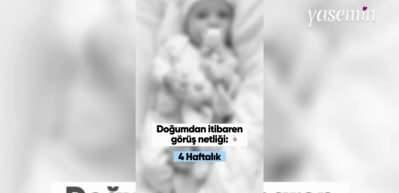 Bebeklerin doğumdan itibaren görüş netliği nasıl olur?