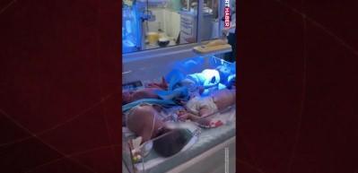 Gazzeli bebekler hayatta kalma savaşı veriyor