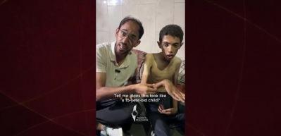 Gazze a&ccedil;lıktan &ouml;l&uuml;yor! Neredeyse her &uuml;&ccedil; kişiden biri g&uuml;nlerdir hi&ccedil;bir şey yemiyor