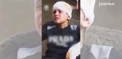 Gazze’de annesini kaybeden yaralı çocuğun feryadı yürek dağladı!