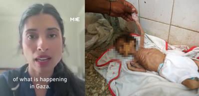 ABD'li Dr. Syed korkunç Gazze gerçeğini açıkladı: Gıda verseniz de ölecekler!