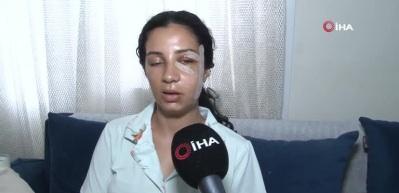 Eski eşinden şiddet g&ouml;ren kadın: "Ben yaşarken kurtulayım, &ouml;ld&uuml;kten sonra değil"