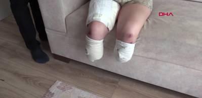 Evlilik yıl d&ouml;n&uuml;m&uuml;nde bacaklarını kaybetti 