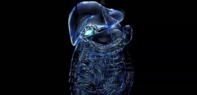 Hazımsızlık deyip geçmeyin: Altında safra kesesi taşı olabilir