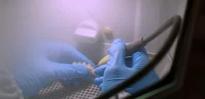 MHP, implant tedavisinin SSK kapsamına girmesi için kanun teklifi önerdi