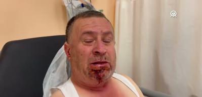 Görgü tanığı hız ve hatalı sollamaya dikkat çekti: 7 ölü, 11 yaralı