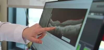 Göz sağlığı ile ilgili önemli uyarı: Sarı nokta hastalığına dikkat!