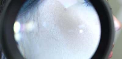 Kış aylarına karşı etkili cilt bakımı önerileri! Kuru, kızarık ve kaşıntılı ciltlere çözüm