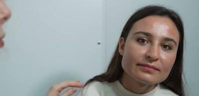 Uzman isim uyardı: Yetişkinler akne sorunuyla karşı karşıya