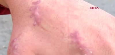 Bu vaka d&uuml;nyada ilk olabilir! Elini ısıran kedi gen&ccedil; adamın kabusu oldu