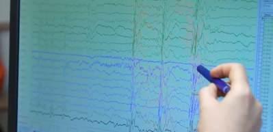 Uzman isim a&ccedil;ıkladı: İşte epilepsinin g&ouml;zden ka&ccedil;an 5 işareti 