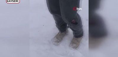 Kayseri&rsquo;de başıboş k&ouml;peğinin saldırısına uğrayan &ccedil;ocuk yaralandı