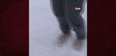 Kayseri&rsquo;de sokak k&ouml;peğinin saldırısına uğrayan &ccedil;ocuk yaralandı