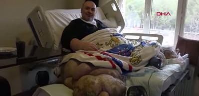 12 yıldır lenf&ouml;demle m&uuml;cadele eden 300 kiloluk Engin Akbadal tedavi i&ccedil;in Ankara&rsquo;ya g&ouml;t&uuml;r&uuml;ld&uuml;