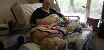 30 kişi tarafından evinden &ccedil;ıkarılan fil hastası, Ankara'ya g&ouml;t&uuml;r&uuml;ld&uuml;.