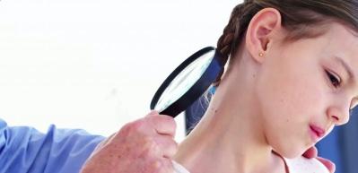 &Ccedil;ocuklarda benler masum mu, risk sinyali mi? 