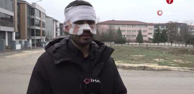 Eskişehir'de &ouml;ğretmen meslektaşının y&uuml;z&uuml;n&uuml; yaktı iddiası