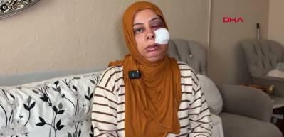 Hatay'da korkun&ccedil; kaza: Dişleri kırıldı, y&uuml;z&uuml;ne 14 dikiş atıldı