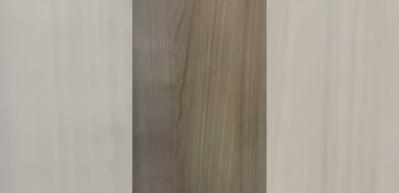 Ufuk &Ouml;zkan'ın nakil &ouml;ncesi g&ouml;r&uuml;nt&uuml;leri ortaya &ccedil;ıktı! 'Ş&uuml;k&uuml;r yaşlarını asla unutmayacağız'