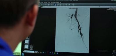 Kritik uyarı: Bacağınız kalp krizi ge&ccedil;iriyor olabilir mi?