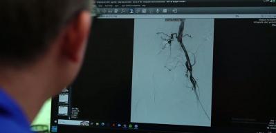 Uzman isim dikkat &ccedil;ekti: 2050'de 3 milyon kişi uzvunu kaybedebilir 