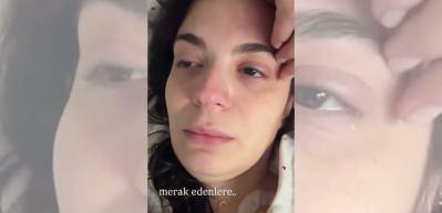 7. kez ameliyat olmuştu! Aslı Bekiroğlu k&ouml;t&uuml; haberi g&ouml;zyaşları i&ccedil;erisinde verdi