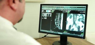 Ge&ccedil;meyen kronik ağrılara &ccedil;&ouml;z&uuml;m: Omurilik pili ve DREZ ameliyatı ile tedavi