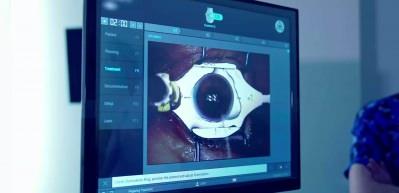 G&ouml;zl&uuml;k ve lens tarih oluyor: Lazerle kalıcı &ccedil;&ouml;z&uuml;m