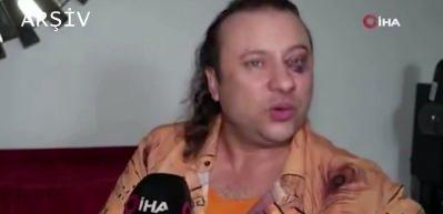 &Uuml;nl&uuml; şarkıcı Onur Akay, ent&uuml;be edildi